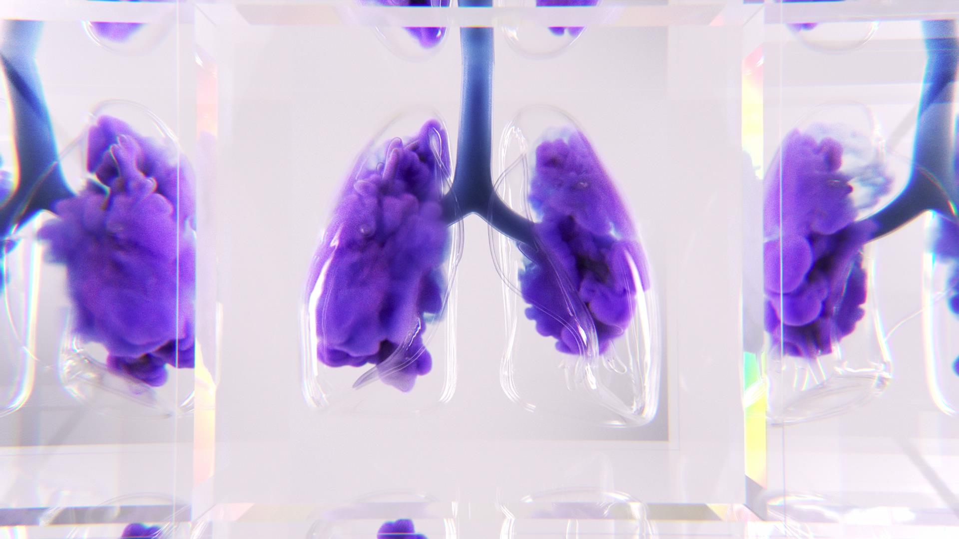 Lungs_A